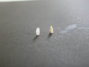 子供たちにお灸を据えてみた、「お灸体験会」