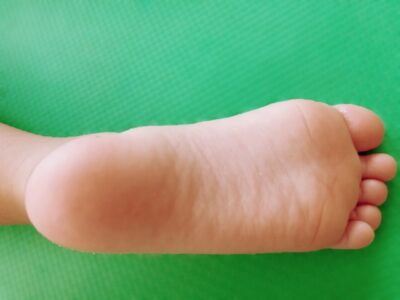 足裏のアーチが重要